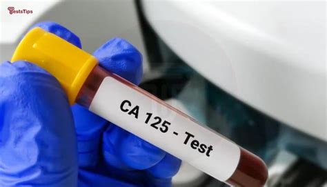 ca125 blood test bottle|high ca 125 levels.